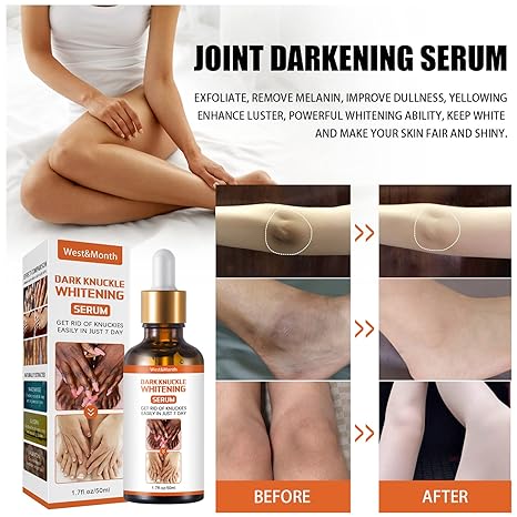 Dark Knuckles Whitening Serum™