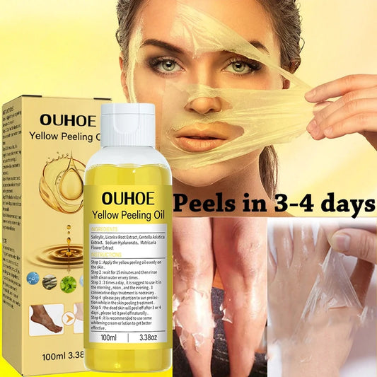 Embrace Radiance with Yellow Peeling Oil