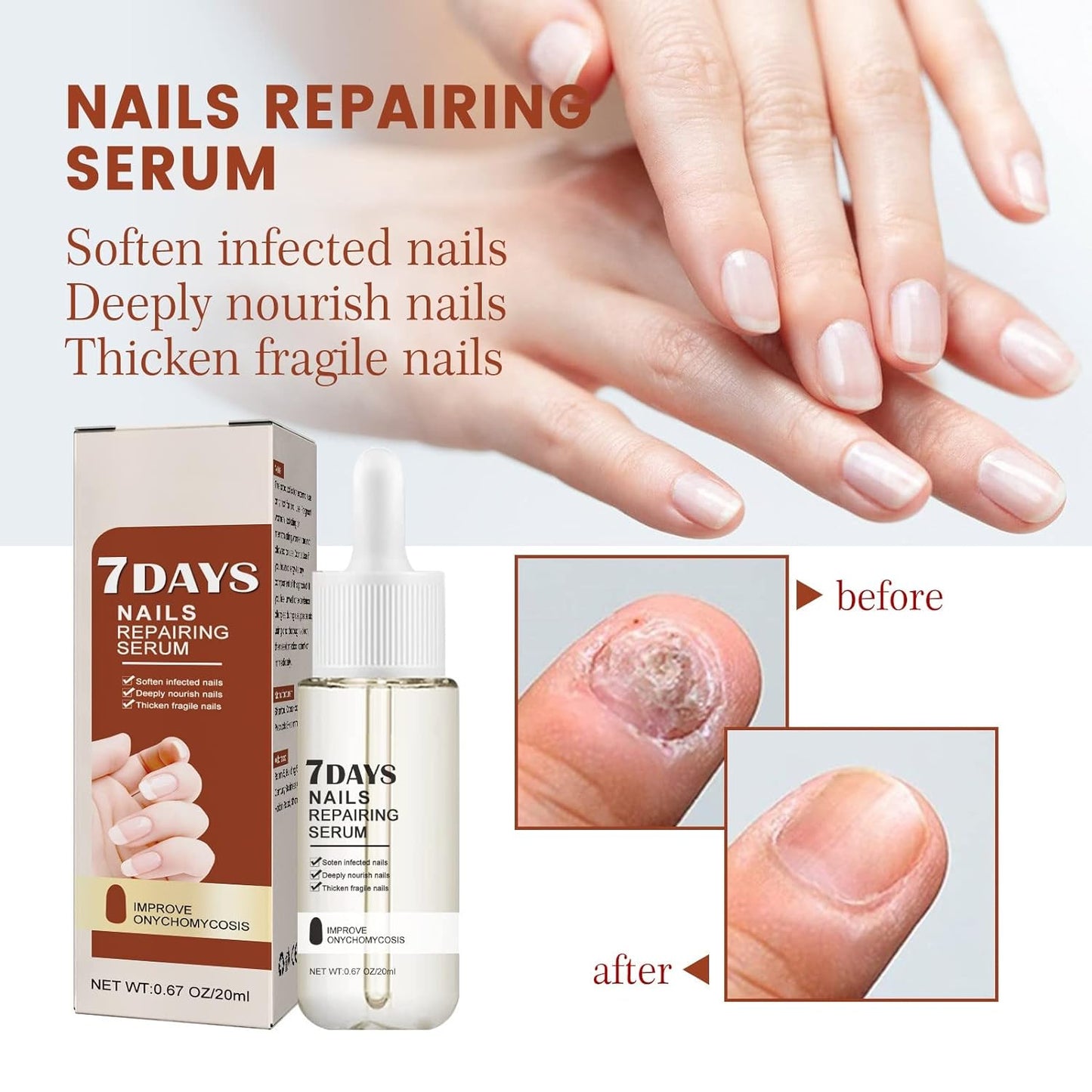 GFOUK™ 7 Days Nail Growth and Strengthening Serum